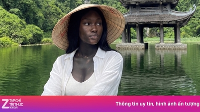 Trang An'da otele giriş yaparak sansasyon yaratan 'vitiligo hastası güzel kız' hakkındaki gerçekler.
