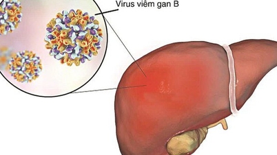 Can hepatitis B be transmitted through food, hugging, or kissing, and how can it be prevented?