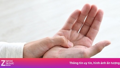 Mati rasa di tangan bisa menjadi tanda peringatan stroke.