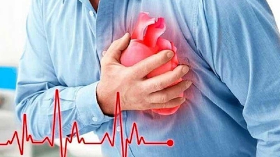 بعد جلسة شرب، أصيب رجل يبلغ من العمر 37 عامًا باحتشاء حاد في عضلة القلب: وقد حدد الأطباء السبب.