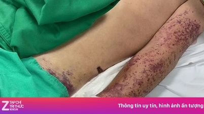 한 남성이 가장 좋아하는 음식 때문에 위독한 상태에 빠졌다.