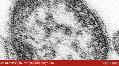 Nhật Bản ghi nhận hơn 500 ca sởi trong năm nay