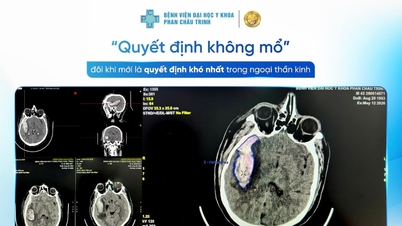 Decyzja o nieoperowaniu jest czasami najtrudniejszą decyzją w neurochirurgii.