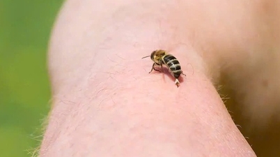 While cycling for exercise, a man unexpectedly suffered a life-threatening anaphylactic shock.
