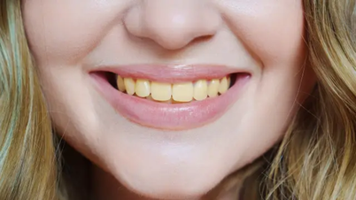 ผู้เชี่ยวชาญชี้ให้เห็นอาหาร 4 ชนิดที่ทำให้ฟันเหลือง และการแปรงฟันมากแค่ไหนก็ไม่สามารถทำให้ฟันขาวขึ้นได้
