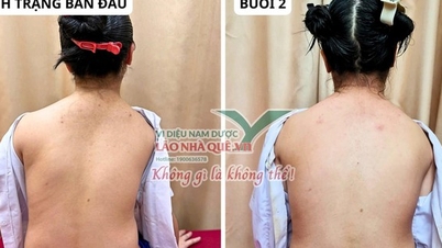 Aprenda sobre o princípio de "Desbloqueio da Coluna Vertebral" do Velho Camponês.