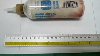 Seorang pemuda yang memasukkan botol plastik ke dalam anusnya harus dirawat di rumah sakit untuk menjalani operasi guna mengeluarkan benda asing tersebut.