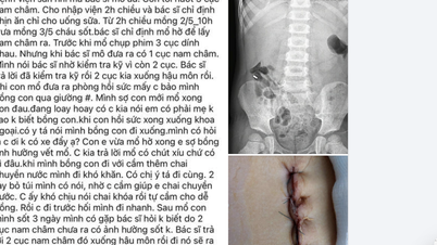Un hôpital s'exprime sur le cas d'un enfant patient à qui l'aimant a « disparu » pendant une intervention chirurgicale.