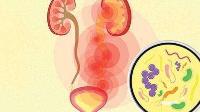 Nhiễm khuẩn tiết niệu có biểu hiện như thế nào?