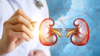 ¿Tiene tratamiento la insuficiencia renal aguda y cuáles son las formas eficaces de prevenirla?