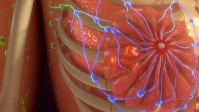 薬物療法を必要としない、新しいがん治療技術。