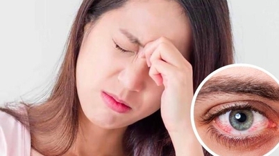 Đau hốc mắt cảnh báo bệnh gì?