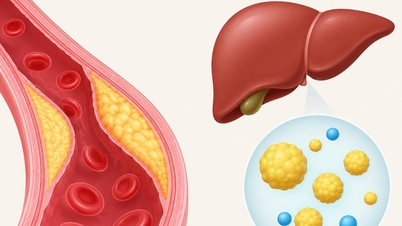 Formas eficazes de controlar o colesterol