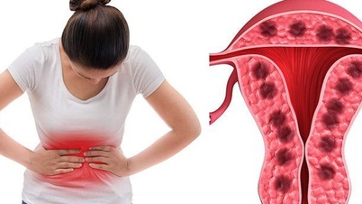Una mujer de 45 años con diabetes estuvo a punto de sufrir complicaciones graves debido a una afección ginecológica prolongada.