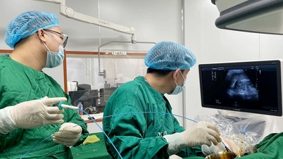 Seorang pria secara tidak sengaja menelan tusuk gigi yang tersangkut di hatinya, untungnya terhindar dari operasi besar.