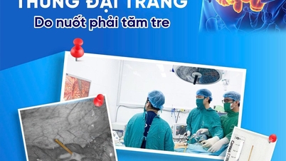 Een man in Vinh Bao heeft een geperforeerde darm opgelopen doordat hij na een maaltijd op bamboestokjes kauwde.