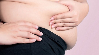 Pessoas com barriga grande têm maior risco de sofrer acidente vascular cerebral (AVC) e ataque cardíaco.