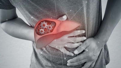 La cirrosi è reversibile?