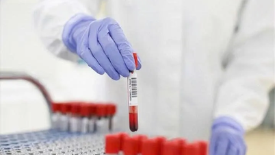 القطاع الطبي يتنافس على المواد الكيميائية المختبرية: لا تحولوا الشركات إلى "مستودعات إمداد لا قعر لها"!