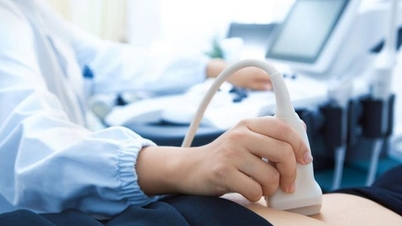 Cảnh báo u buồng trứng ở phụ nữ lớn tuổi