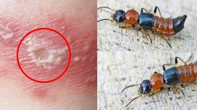 5 pasos para manejar adecuadamente el contacto con hormigas de tres segmentos.
