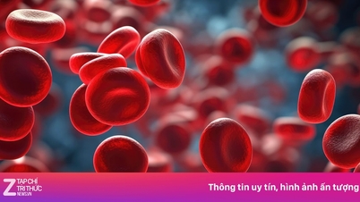 Enkelte blodtyper har høyere risiko for å utvikle type 2 diabetes.