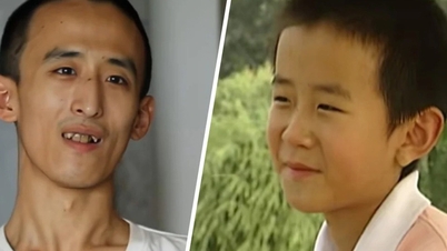 La tragica storia di un bambino prodigio di 10 anni che ha superato gli esami di ammissione all'università, ha conseguito un dottorato a 16 anni, ma è cresciuto disoccupato e dipendente dal sussidio dei genitori.