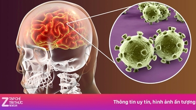 Japansk encephalitis - en førende og farlig infektionssygdom hos børn.
