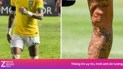 Neymar's photo showing his deformed left leg has garnered over 7 million views.