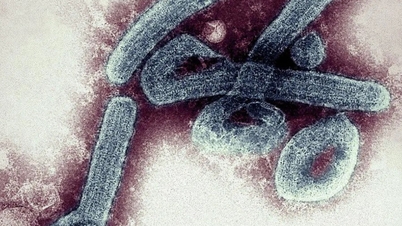 Cholera outbreak in the Central African Republic
