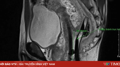Un tip de accidentare deosebit de rar, neînregistrat până acum în Vietnam.