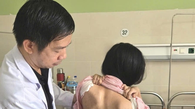Rumah Sakit Da Nang menawarkan pemeriksaan skoliosis gratis untuk anak-anak.