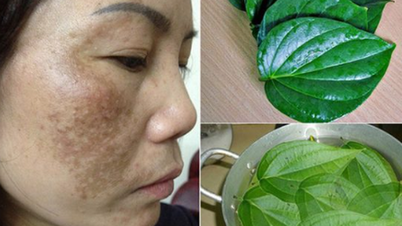 Her er fire naturlige, rimelige, men svært effektive måter å behandle gjenstridig melasma på.