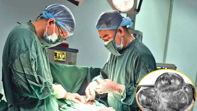 Cirugía exitosa para extirpar un tumor ovárico de 5 kg en una mujer anciana.