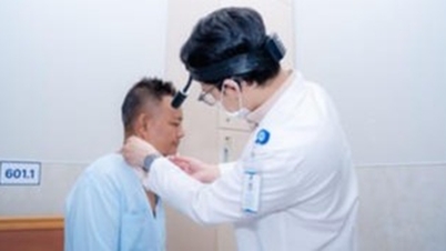 Complicação perigosa de abscesso profundo no pescoço devido a dois dentes cariados não tratados.