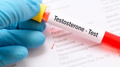 Giảm testosterone ở nam giới: Những dấu hiệu cảnh báo không nên bỏ qua