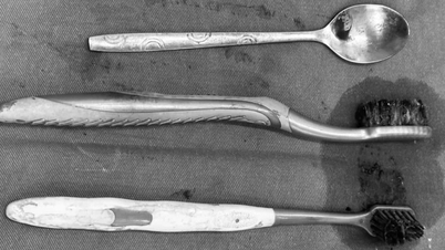 Le médecin a retiré deux brosses à dents et une cuillère en acier inoxydable de l'estomac du patient.