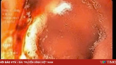 의사와 상담 없이 오래된 처방전을 재사용할 경우의 위험성.