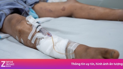 সামান্য একটি আঁচড় উপেক্ষা করে লোকটি মৃত্যুর মুখোমুখি হয়েছিল।