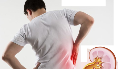 What are the possible consequences of urinary stones?