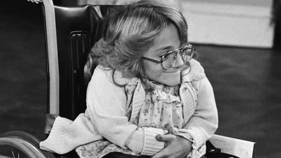 L'actrice Melanie Watson, atteinte d'ostéogenèse imparfaite (maladie des os de verre), est décédée à l'âge de 57 ans.