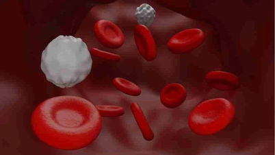 Preventing the risk of dyslipidemia during the year-end period.